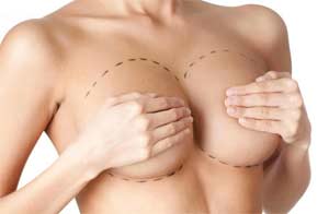 Protheses mammaires Dr Benzaken